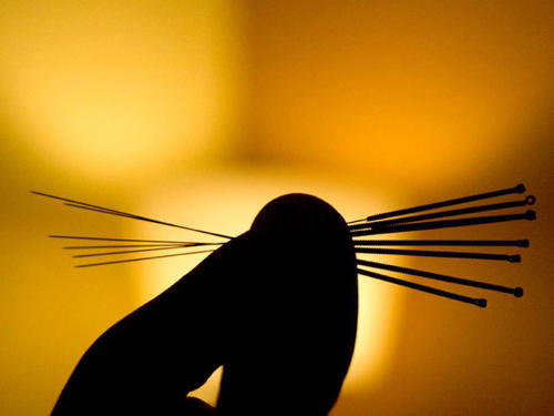 中醫(yī)器械的產(chǎn)品設計思路